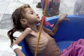 Tragedija Jemena slična je tragediji Bosne, stalne pogibje, totalna blokada, umiranje od gladi i pothranjenosti (AP)