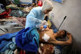 Palestinac koji je ranjen u izraelskoj pucnjavi dok je čekao pomoć, leži na krevetu u bolnici Al-Shifa, u Gazi, 1. marta 2024. godine (Kosay Al Nemer/Reuters)